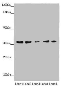 MTHFD2 Antibody - Western blot All lanes: MTHFD2 antibody at 4.99µg/ml Lane 1: 293 whole cell lysate Lane 2: A431 whole cell lysate Lane 3: HepG2 whole cell lysate Lane 4: Hela whole cell lysate Lane 5: K562 whole cell lysate Secondary Goat polyclonal to rabbit IgG at 1/10000 dilution Predicted band size: 38, 27 kDa Observed band size: 38 kDa