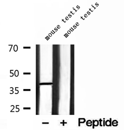 MTHFD2 Antibody - Western blot analysis of extracts of mouse testis tissue using MTHFD2 antibody.