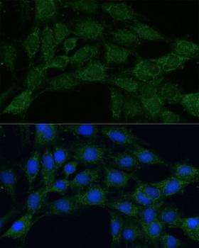 MTHFD2 Antibody - Immunofluorescence analysis of C6 cells using MTHFD2 Polyclonal Antibody at dilution of 1:100.Blue: DAPI for nuclear staining.