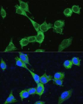 MTHFD2 Antibody - Immunofluorescence analysis of NIH/3T3 cells using MTHFD2 Polyclonal Antibody at dilution of 1:100.Blue: DAPI for nuclear staining.