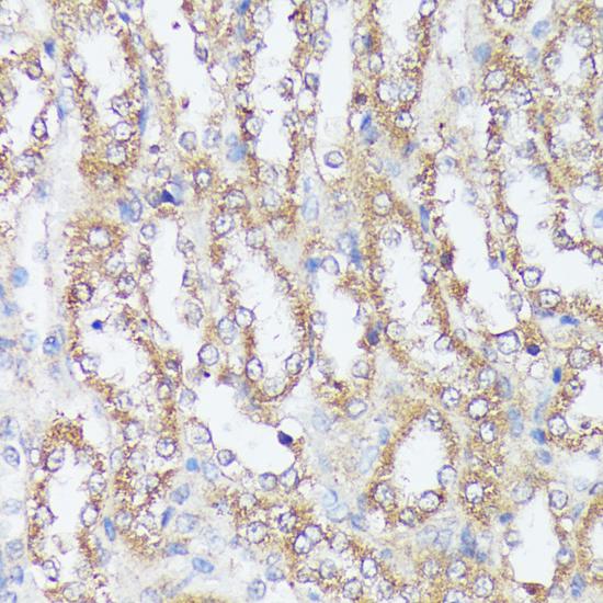 MTHFD2 Antibody - Immunohistochemistry of paraffin-embedded Rat kidney using MTHFD2 Polyclonal Antibody at dilution of 1:100 (40x lens).