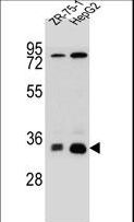 MTHFD2L Antibody - MTHFD2L Antibody western blot of HepG2,ZR-75-1 cell line lysates (35 ug/lane). The MTHFD2L antibody detected the MTHFD2L protein (arrow).