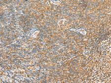 MTHFD2L Antibody - Immunohistochemistry of paraffin-embedded Human tonsil tissue  using MTHFD2L Polyclonal Antibody at dilution of 1:30(×200)