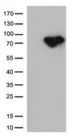 MTHFR Antibody - HEK293T cells were transfected with the pCMV6-ENTRY control. (Left lane) or pCMV6-ENTRY MTHFR. (Right lane) cDNA for 48 hrs and lysed. Equivalent amounts of cell lysates. (5 ug per lane) were separated by SDS-PAGE and immunoblotted with anti-MTHFR. (1:500)