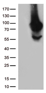 MTHFR Antibody - HEK293T cells were transfected with the pCMV6-ENTRY control. (Left lane) or pCMV6-ENTRY MTHFR. (Right lane) cDNA for 48 hrs and lysed. Equivalent amounts of cell lysates. (5 ug per lane) were separated by SDS-PAGE and immunoblotted with anti-MTHFR. (1:500)