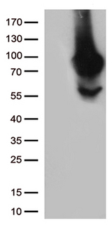 MTHFR Antibody - HEK293T cells were transfected with the pCMV6-ENTRY control. (Left lane) or pCMV6-ENTRY MTHFR. (Right lane) cDNA for 48 hrs and lysed