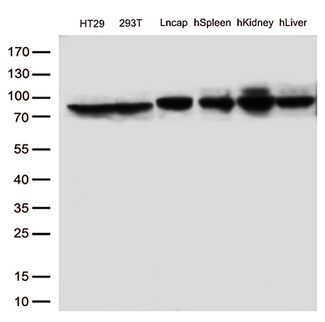 MTHFR Antibody - Western blot analysis of extracts. (35ug) from 3 cell lines and 3 tissue lysates by using anti-MTHFR monoclonal antibody. (1:250)