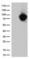 MTHFR Antibody - HEK293T cells were transfected with the pCMV6-ENTRY control. (Left lane) or pCMV6-ENTRY MTHFR. (Right lane) cDNA for 48 hrs and lysed. Equivalent amounts of cell lysates. (5 ug per lane) were separated by SDS-PAGE and immunoblotted with anti-MTHFR. (1:500)