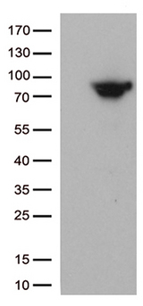 MTHFR Antibody - HEK293T cells were transfected with the pCMV6-ENTRY control. (Left lane) or pCMV6-ENTRY MTHFR. (Right lane) cDNA for 48 hrs and lysed