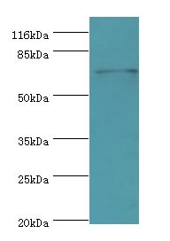 MTHFR Antibody - Western blot. All lanes: MTHFR antibody at 2 ug/ml+293T whole cell lysate. Secondary antibody: goat polyclonal to rabbit at 1:10000 dilution. Predicted band size: 75 kDa. Observed band size: 75 kDa.  This image was taken for the unconjugated form of this product. Other forms have not been tested.