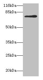 MTHFR Antibody - Western blot All lanes: MTHFR antibody at 2µg/ml + 293T whole cell lysate Secondary Goat polyclonal to rabbit IgG at 1/10000 dilution Predicted band size: 75, 79 kDa Observed band size: 75 kDa