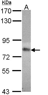 MTHFR Antibody - Sample (30 ug of whole cell lysate). A:293T. 7.5% SDS PAGE. MTHFR antibody diluted at 1:1000.