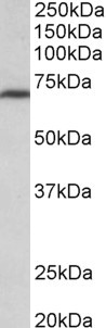 MTHFR Antibody - MTHFR antibody (0.3 ug/ml) staining of NIH3T3 lysate (35 ug protein in RIPA buffer). Primary incubation was 1 hour. Detected by chemiluminescence.