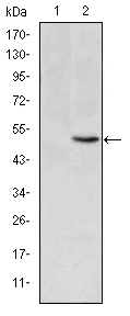MTHFR Antibody - Western blot using MTHFR monoclonal antibody against HEK293 (1) and MTHFR(AA: 339-499)-hIgGFc transfected HEK293 (2) cell lysate.