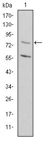 MTHFR Antibody - MTHFR Antibody in Western Blot (WB)
