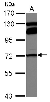 MTHFR Antibody - Sample (30 ug of whole cell lysate) A: A549 7.5% SDS PAGE MTHFR antibody diluted at 1:1000