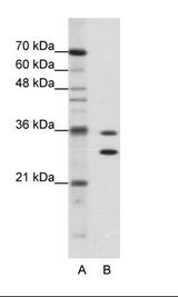 MTHFSD Antibody - A: Marker, B: Jurkat Cell Lysate.  This image was taken for the unconjugated form of this product. Other forms have not been tested.
