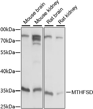 MTHFSD Antibody - Western blot analysis of extracts of various cell lines, using MTHFSD antibody at 1:1000 dilution. The secondary antibody used was an HRP Goat Anti-Rabbit IgG (H+L) at 1:10000 dilution. Lysates were loaded 25ug per lane and 3% nonfat dry milk in TBST was used for blocking. An ECL Kit was used for detection and the exposure time was 5s.