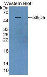 MTIF2 Antibody - Western Blot; Sample: Recombinant protein.