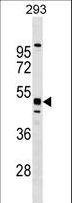 MTL5 / TESMIN Antibody - MTL5 Antibody western blot of 293 cell line lysates (35 ug/lane). The MTL5 antibody detected the MTL5 protein (arrow).