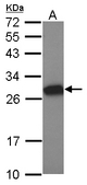 MTL5 / TESMIN Antibody - Sample (30 ug of whole cell lysate) A: NT2D1 12% SDS PAGE MTL5 antibody diluted at 1:1000