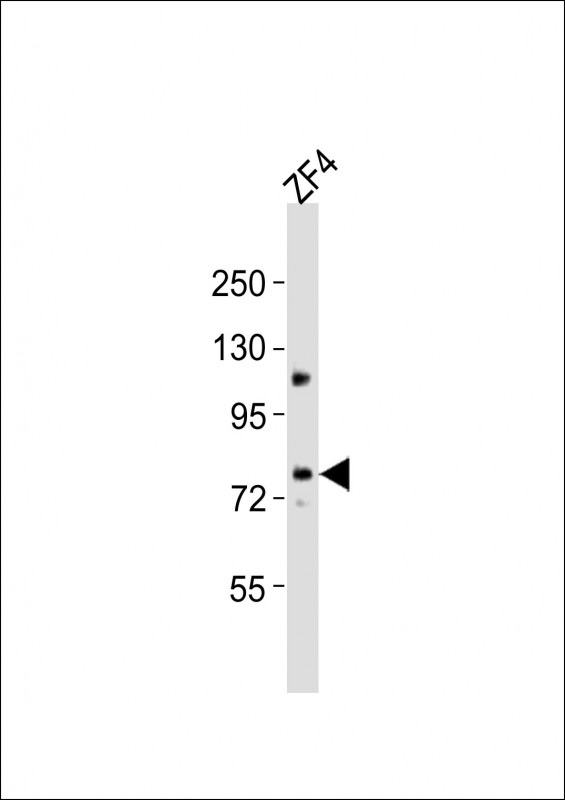 MTM1 / Myotubularin Antibody - Anti-mtm1 Antibody at 1:2000 dilution + ZF4 whole cell lysates Lysates/proteins at 20 ug per lane. Secondary Goat Anti-Rabbit IgG, (H+L), Peroxidase conjugated at 1/10000 dilution Predicted band size : 74 kDa Blocking/Dilution buffer: 5% NFDM/TBST.