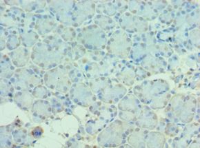 MTM1 / Myotubularin Antibody - Immunohistochemistry of paraffin-embedded human pancreas using antibody at 1:100 dilution.