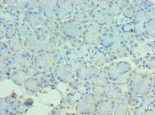 MTM1 / Myotubularin Antibody - Immunohistochemistry of paraffin-embedded human pancreas using antibody at 1:100 dilution.
