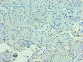 MTM1 / Myotubularin Antibody - Immunohistochemistry of paraffin-embedded human pancreatic tissue using MTM1 Antibody at dilution of 1:100