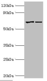 MTM1 / Myotubularin Antibody - Western blot All lanes: Myotubularin antibody at 2µg/ml Lane 1: Jurkat whole cell lysate Lane 2: HepG2 whole cell lysate Secondary Goat polyclonal to rabbit IgG at 1/10000 dilution Predicted band size: 70, 67 kDa Observed band size: 70 kDa