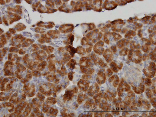 MTM1 / Myotubularin Antibody - Immunoperoxidase of monoclonal antibody to MTM1 on formalin-fixed paraffin-embedded human pancreas. [antibody concentration 3 ug/ml]