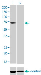MTM1 / Myotubularin Antibody - Western blot of MTM1 over-expressed 293 cell line, cotransfected with MTM1 Validated Chimera RNAi (Lane 2) or non-transfected control (Lane 1). Blot probed with MTM1 monoclonal antibody, clone 1C10. GAPDH ( 36.1 kD ) used as specificity a.