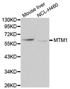 MTM1 / Myotubularin Antibody - Western blot analysis of extracts of various cell lines, using MTM1 antibody at 1:1000 dilution. The secondary antibody used was an HRP Goat Anti-Rabbit IgG (H+L) at 1:10000 dilution. Lysates were loaded 25ug per lane and 3% nonfat dry milk in TBST was used for blocking.