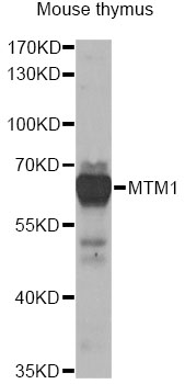 MTM1 / Myotubularin Antibody - Western blot analysis of extracts of mouse thymus, using MTM1 antibody at 1:1000 dilution. The secondary antibody used was an HRP Goat Anti-Rabbit IgG (H+L) at 1:10000 dilution. Lysates were loaded 25ug per lane and 3% nonfat dry milk in TBST was used for blocking. An ECL Kit was used for detection and the exposure time was 30s.