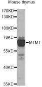 MTM1 / Myotubularin Antibody - Western blot analysis of extracts of mouse thymus, using MTM1 antibody at 1:1000 dilution. The secondary antibody used was an HRP Goat Anti-Rabbit IgG (H+L) at 1:10000 dilution. Lysates were loaded 25ug per lane and 3% nonfat dry milk in TBST was used for blocking. An ECL Kit was used for detection and the exposure time was 30s.