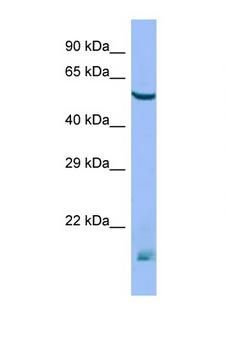 MTM1 / Myotubularin Antibody - MTM1 antibody Western blot of Mouse Thymus lysate. Antibody concentration 1 ug/ml.  This image was taken for the unconjugated form of this product. Other forms have not been tested.