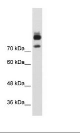 MTMR1 Antibody - HepG2 Cell Lysate.  This image was taken for the unconjugated form of this product. Other forms have not been tested.