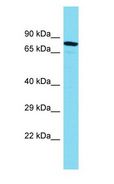 MTMR10 Antibody - MTMR10 antibody Western Blot of ACHN. Antibody dilution: 1 ug/ml.  This image was taken for the unconjugated form of this product. Other forms have not been tested.