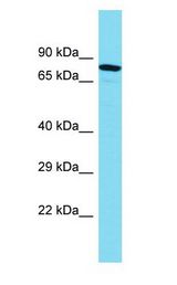 MTMR10 Antibody - MTMR10 antibody Western Blot of ACHN. Antibody dilution: 1 ug/ml.  This image was taken for the unconjugated form of this product. Other forms have not been tested.