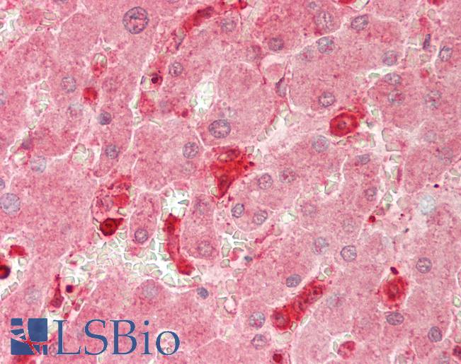 MTMR12 Antibody - Human Liver: Formalin-Fixed, Paraffin-Embedded (FFPE).  This image was taken for the unconjugated form of this product. Other forms have not been tested.