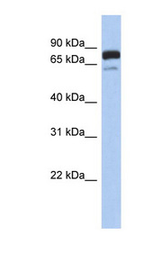 MTMR12 Antibody - MTMR12 antibody western blot of Human fetal brain lysate.  This image was taken for the unconjugated form of this product. Other forms have not been tested.