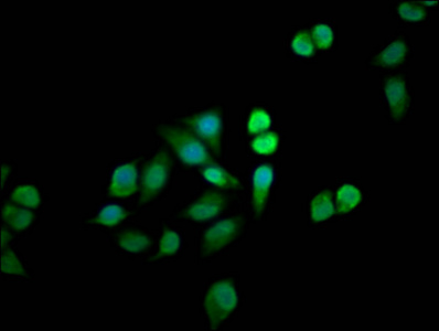 MTMR12 Antibody - Immunofluorescence staining of Hela cells diluted at 1:33, counter-stained with DAPI. The cells were fixed in 4% formaldehyde, permeabilized using 0.2% Triton X-100 and blocked in 10% normal Goat Serum. The cells were then incubated with the antibody overnight at 4°C.The Secondary antibody was Alexa Fluor 488-congugated AffiniPure Goat Anti-Rabbit IgG (H+L).