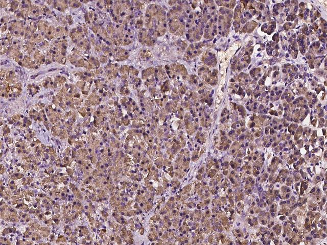 MTMR12 Antibody - Immunochemical staining of human MTMR12 in human pancreas with rabbit polyclonal antibody at 1:100 dilution, formalin-fixed paraffin embedded sections.
