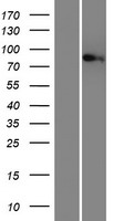 MTMR12 Protein - Western validation with an anti-DDK antibody * L: Control HEK293 lysate R: Over-expression lysate