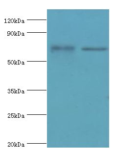 MTMR14 Antibody - Western blot. All lanes: Myotubularin-related protein 14 antibody at 10 ug/ml. Lane 1: HeLa whole cell lysate. Lane 2: mouse skeletal muscle tissue. secondary Goat polyclonal to rabbit at 1:10000 dilution. Predicted band size: 72 kDa. Observed band size: 72 kDa.