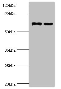 MTMR14 Antibody - Western blot All lanes: Myotubularin-related protein 14 antibody at 10µg/ml Lane 1: Hela whole cell lysate Lane 2: Mouse skeletal muscle tissue Secondary Goat polyclonal to rabbit IgG at 1/10000 dilution Predicted band size: 73, 67, 61 kDa Observed band size: 73 kDa