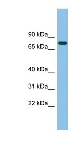 MTMR14 Antibody - MTMR14 antibody Western blot of Fetal Heart lysate. This image was taken for the unconjugated form of this product. Other forms have not been tested.