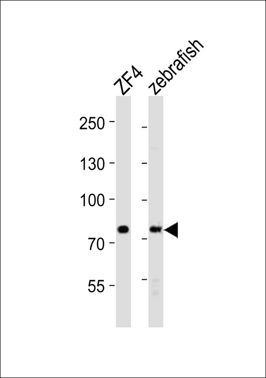 MTMR14 Antibody - Western blot analysis of lysates from zebra fish ZF4 cell line, zebrafish tissue lysate (from left to right), using (zebrafish) mtmr14 Antibody (C-Term). (DANRE) mtmr14 Antibody (C-Term) was diluted at 1:1000 at each lane. A goat anti-rabbit IgG H&L (HRP) at 1:10000 dilution was used as the secondary antibody. Lysates at 20ug per lane.