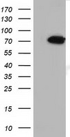 MTMR14 Antibody - HEK293T cells were transfected with the pCMV6-ENTRY control (Left lane) or pCMV6-ENTRY MTMR14 (Right lane) cDNA for 48 hrs and lysed. Equivalent amounts of cell lysates (5 ug per lane) were separated by SDS-PAGE and immunoblotted with anti-MTMR14.