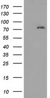 MTMR14 Antibody - HEK293T cells were transfected with the pCMV6-ENTRY control (Left lane) or pCMV6-ENTRY MTMR14 (Right lane) cDNA for 48 hrs and lysed. Equivalent amounts of cell lysates (5 ug per lane) were separated by SDS-PAGE and immunoblotted with anti-MTMR14.